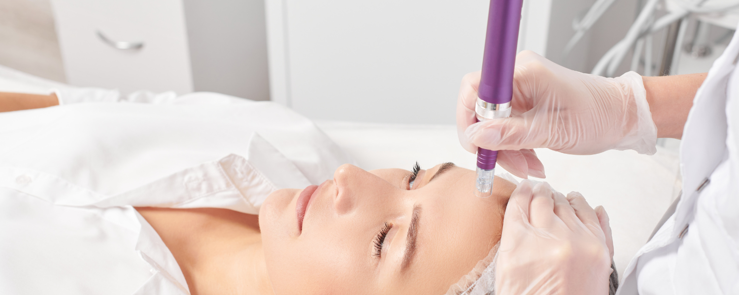 Microneedling